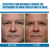 Men's Eye Serum Reduces Fine Lines, Bags, Dark Circles, Moisturizes, Firming, Brightening And Anti-Aging Eye Area - V.I.P Digital Presence