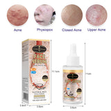 Rice Original Liquid 40ml Essence Rice Moisturizing Brightening Moisturizing Original Liquid - V.I.P Digital Presence