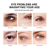 Snake Venom Eye Cream, Firming Eye Bags Hydrating And Reducing Fine Lines Eye Care Eye Cream - V.I.P Digital Presence