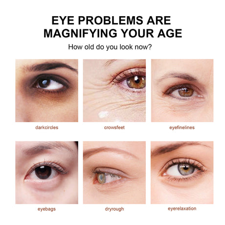 Snake Venom Eye Cream, Firming Eye Bags Hydrating And Reducing Fine Lines Eye Care Eye Cream - V.I.P Digital Presence