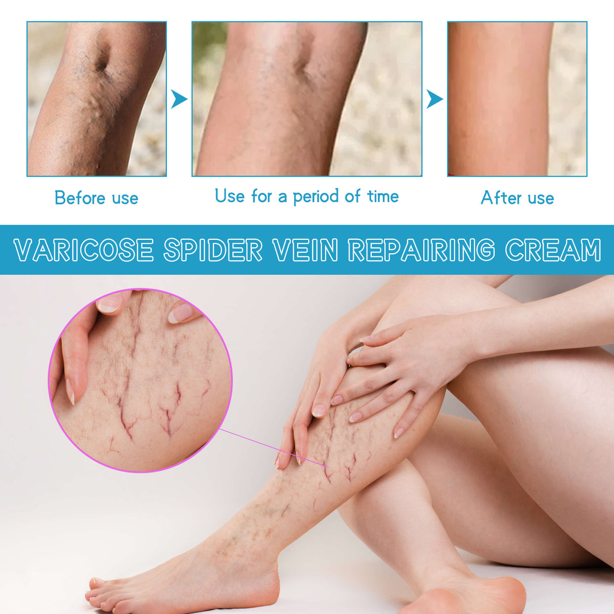 Varicose Spider Vein Repairing Cream, Relief Leg Pain Earthworm Leg Veins Care Massage Cream - V.I.P Digital Presence