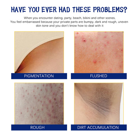 Body Whitening Cream, Lightening Dull Skin Even Skin Tone Moisturizing Skin Beauty Cream - V.I.P Digital Presence