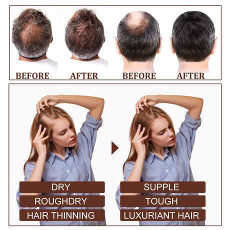 Castor Oil Hair Dense Essential Oil Repair Damaged Hair, Nourish Scalp, Strengthen Hair And Prevent Hair Loss - V.I.P Digital Presence