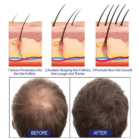 Men's Dense Hair Foam Machine, Repair Hair Root Follicle Men's Hair Thick Moisturizing Foam - V.I.P Digital Presence