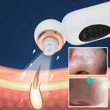 3-Speed Small Bubble Blackhead Instrument Facial Pore Cleaning To Remove Blackhead Beauty Instrument Electric Blackhead Exporter - V.I.P Digital Presence