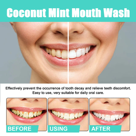 Coconut Mint Mouth Wash, Whitening Teeth Yellow Teeth Stains Tongue Coating Clean Fresh Breath Oral Care - V.I.P Digital Presence