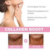 Hydra Collagen Neck Repair Cream, Firming Skin Lighten Neck Lines Moisturizing Beauty Neck Care Cream - V.I.P Digital Presence