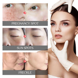Face Brightening Serum, Lighten Dark Spots Moisturizing And Repairing Fine Lines Brightening Serum - V.I.P Digital Presence