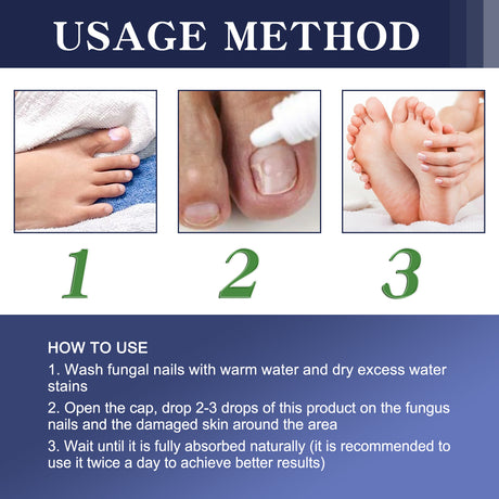Gray Nail Repair Drops, Repair Hand And Foot Gray Nails Soft And Bright Nail Thickening Nail Care Solution - V.I.P Digital Presence