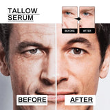 Anti-Wrinkle Serum For Men, Anti-Wrinkle Firming Skin Young Elastic Moisturizing Translucent Essence - V.I.P Digital Presence