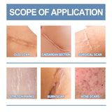 Oceaura Scar Whitening Repair Gel Moisturizes And Smooths Skin Repair Surgery Scar Pregnancy Care Gel - V.I.P Digital Presence