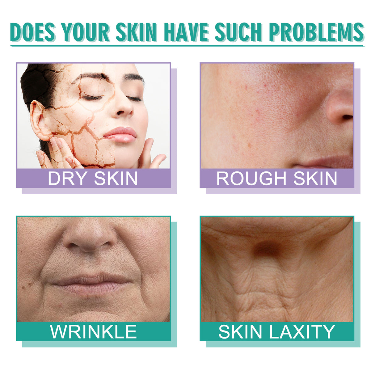Crema hidratante para el cuidado de la piel que reduce manchas oscuras y líneas finas. Crema antiarrugas hidratante, blanqueadora, reafirmante y regeneradora.