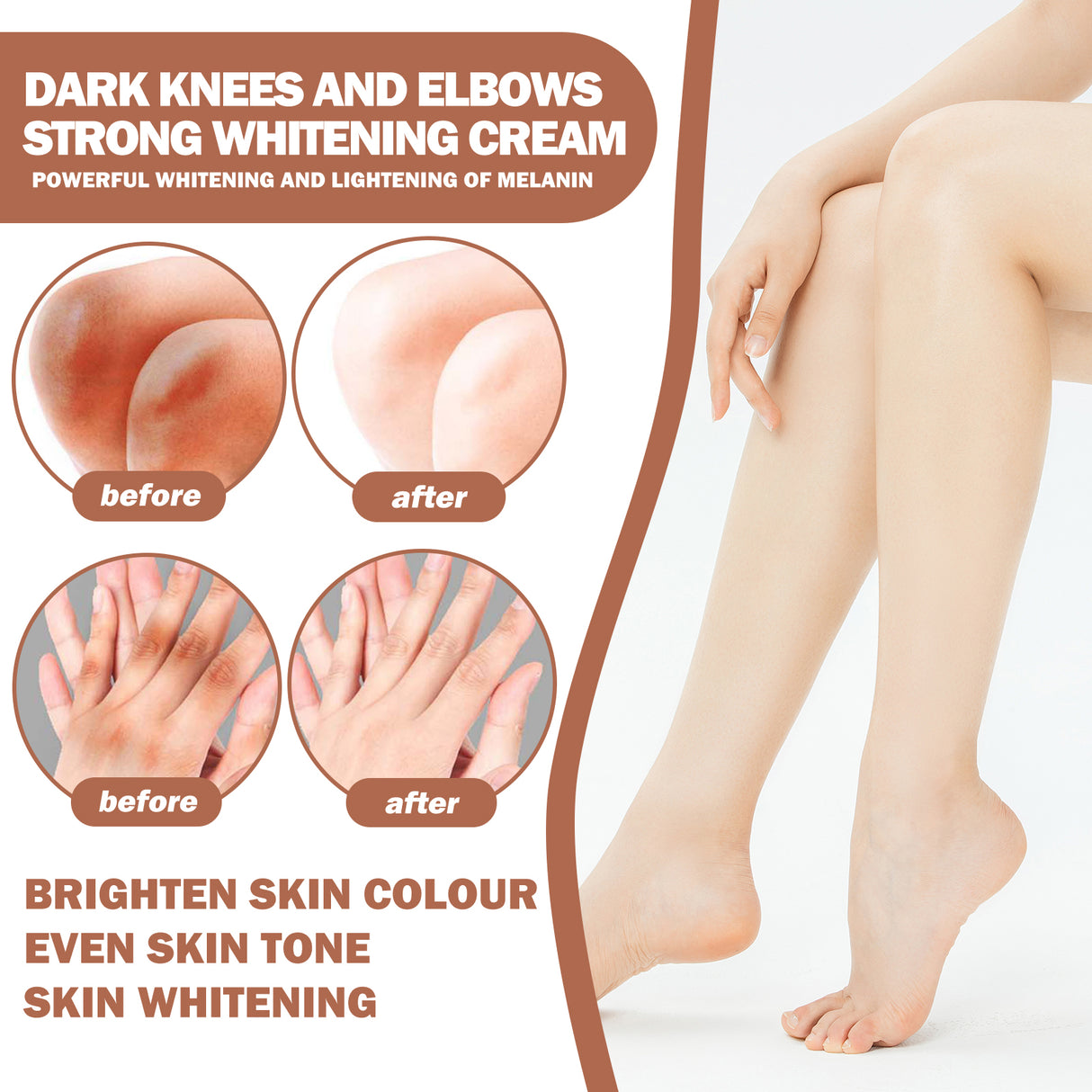 Joint Whitening Cream, Moisturizes Dull Skin Whitening Repair Cream For Joints And Elbows - V.I.P Digital Presence
