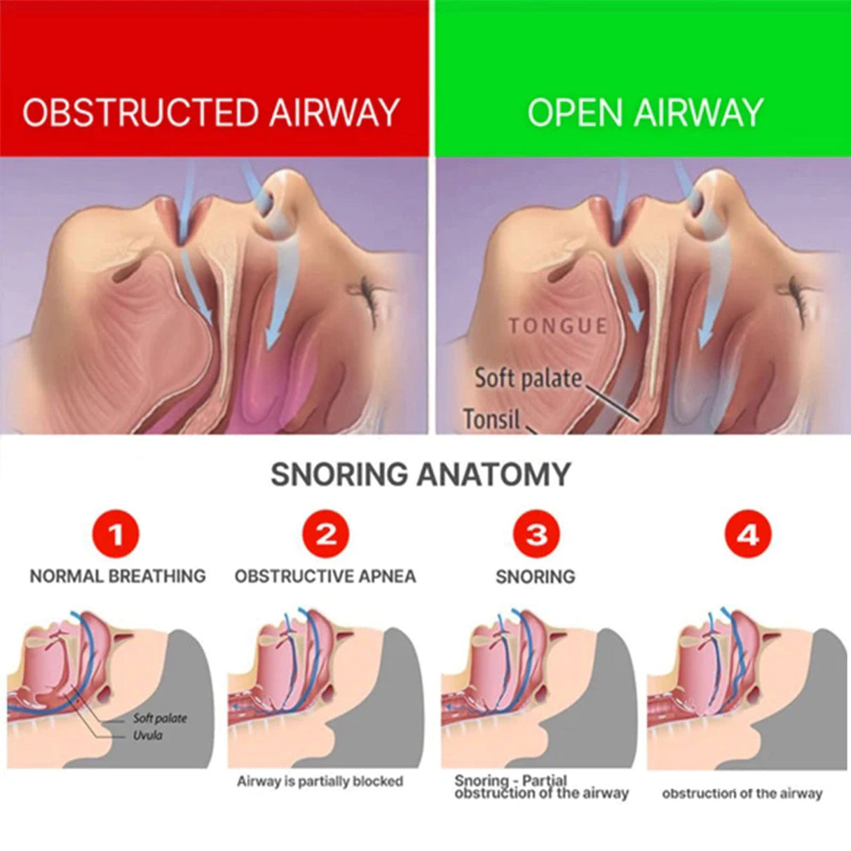 Anti-Snoring Braces Anti-Snoring, Anti-Grinding, Anti-Breathing Mouth Guard Anti-Snoring Dental Support Protective Braces - V.I.P Digital Presence