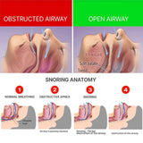 Anti-Snoring Braces Anti-Snoring, Anti-Grinding, Anti-Breathing Mouth Guard Anti-Snoring Dental Support Protective Braces - V.I.P Digital Presence