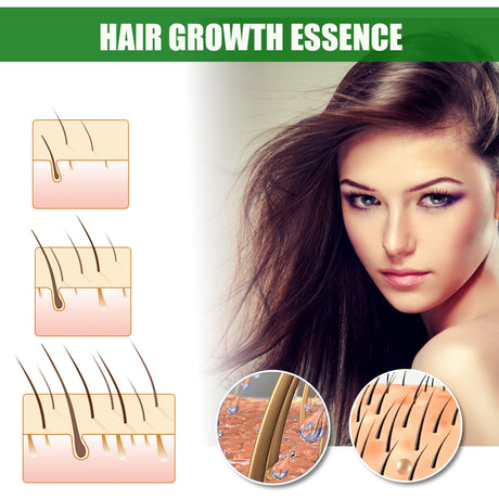 Ginger Hair Growth Spray, Nourishing And Nourishing Hair Root, Hair Care Solution To Prevent Scalp Loss - V.I.P Digital Presence