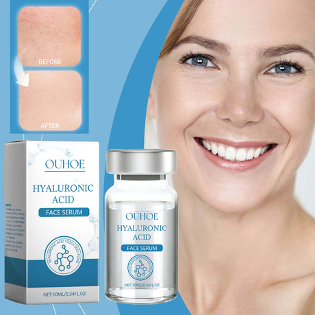 Hyaluronic Acid Face Serum, Facial Gentle Nourishing And Moisturizing Improve Skin Texture - V.I.P Digital Presence