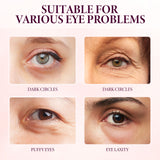 Mango Eye Cream Reduces Fine Lines Of Crow's Feet Bags And Gently Nourishes Elasticity And Tightens The Skin Around Eyes - V.I.P Digital Presence