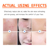Salicylic Acid Facial Mask Gentle Cleansing Mask To Lighten Acne, Seal And Tighten Pores - V.I.P Digital Presence
