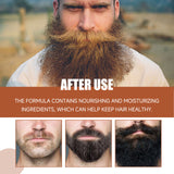 Facial Hair Conditioner, Nourishing And Strengthening Facial Hair Conditioner For Men - V.I.P Digital Presence