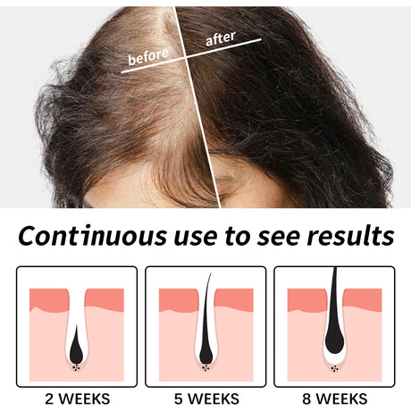 Hair Essence, Repair Dry Hair, Moisturize Hair Roots And Scalp Hair Essence - V.I.P Digital Presence
