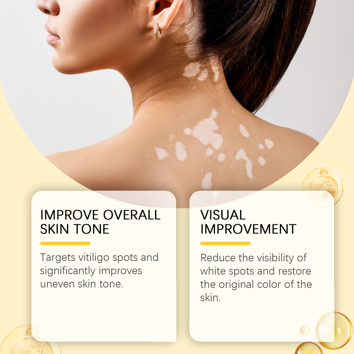 Bee Venom White Spot Care Cream Bee Venom Repair Skin Moisturizing Skin Care Topical Cream - V.I.P Digital Presence