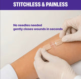 CloseSeal Wound Closure Kit