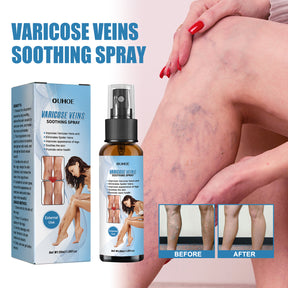 Vein Treatment Spray, Relieve Leg Soreness And Swelling Repair Earthworm Leg Vein Treatment Spray - V.I.P Digital Presence