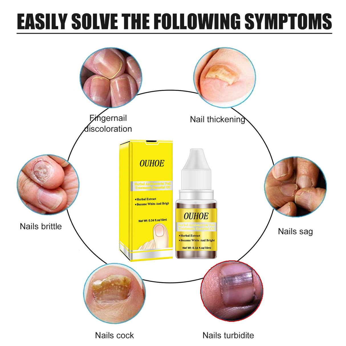 Herbal Antibacterial Nail Treatments Essential Oil, Grey Nail Care Essential Oil Brightening Nail Polish Clean Manicure Foot Care Solution - V.I.P Digital Presence
