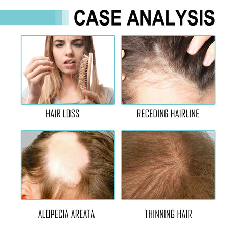 Multi-Peptide Serum For Hair Density, Fall Prevention Dense Hair Repair Damaged Hair Supple Hair Moist Hair Hair Oil - V.I.P Digital Presence
