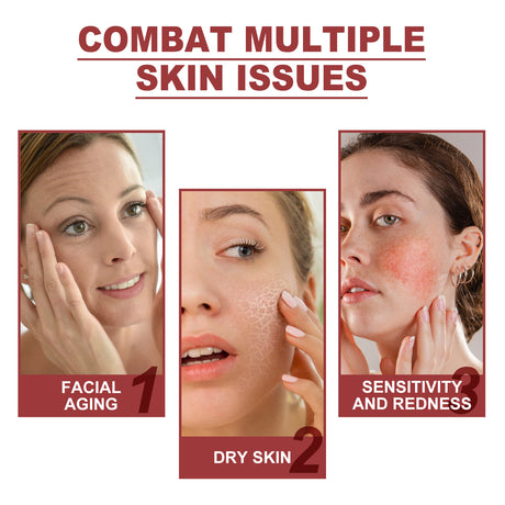 Collagen Membrane, Lighten Wrinkles, Bags, Dark Circles, Firm Skin, Plump And Moisturize Eye Rejuvenation Mask - V.I.P Digital Presence