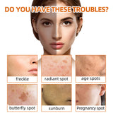 Turmeric Face Soap, Face Repair Gentle Cleansing, Fade Spots And Smooth Fine Lines Cleaner Soap - V.I.P Digital Presence