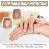 Nail Care Cream Repair Grey Nail Nail Shine Soft Nail Moisturizing Moisturizing Cleansing And Exfoliating Care Cream - V.I.P Digital Presence