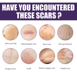 Silicone Scar Patch, Reduces Stretch Marks And Hyperplasia Of Caesarean Section Scars Silicone Patch - V.I.P Digital Presence