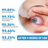 Eye Drops Dryness Soothing, Relieve Eye Fatigue, Dry Eyes, Red Eyes, Blurred Vision Eyes Care Lotion - V.I.P Digital Presence