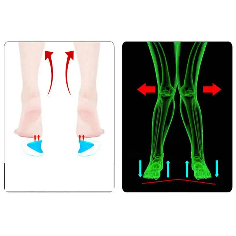 2Pc Arch Support Insole Of Flatfoot Gel Pads For Feet Orthotics Insoles Foot Health Care Massage Muscle Resist Painful Massager - V.I.P Digital Presence