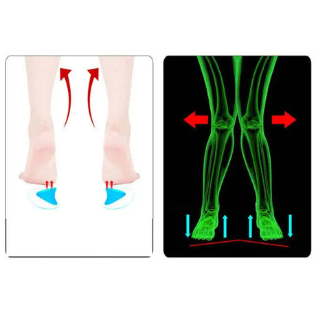 2Pc Arch Support Insole Of Flatfoot Gel Pads For Feet Orthotics Insoles Foot Health Care Massage Muscle Resist Painful Massager - V.I.P Digital Presence