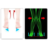 2Pc Arch Support Insole Of Flatfoot Gel Pads For Feet Orthotics Insoles Foot Health Care Massage Muscle Resist Painful Massager - V.I.P Digital Presence