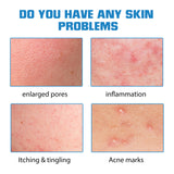 Hyaluronic Acid Face Serum, Moisturizing Repair Lighten Acne Mark Skin Care Whitening Essence - V.I.P Digital Presence