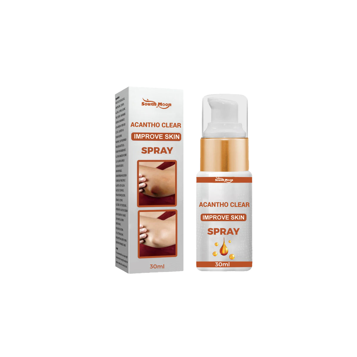 Acantho Clear Improve Skin Spray, Repair Black Spot, Elbow Knee Joint Black Whitening Skin Spray - V.I.P Digital Presence