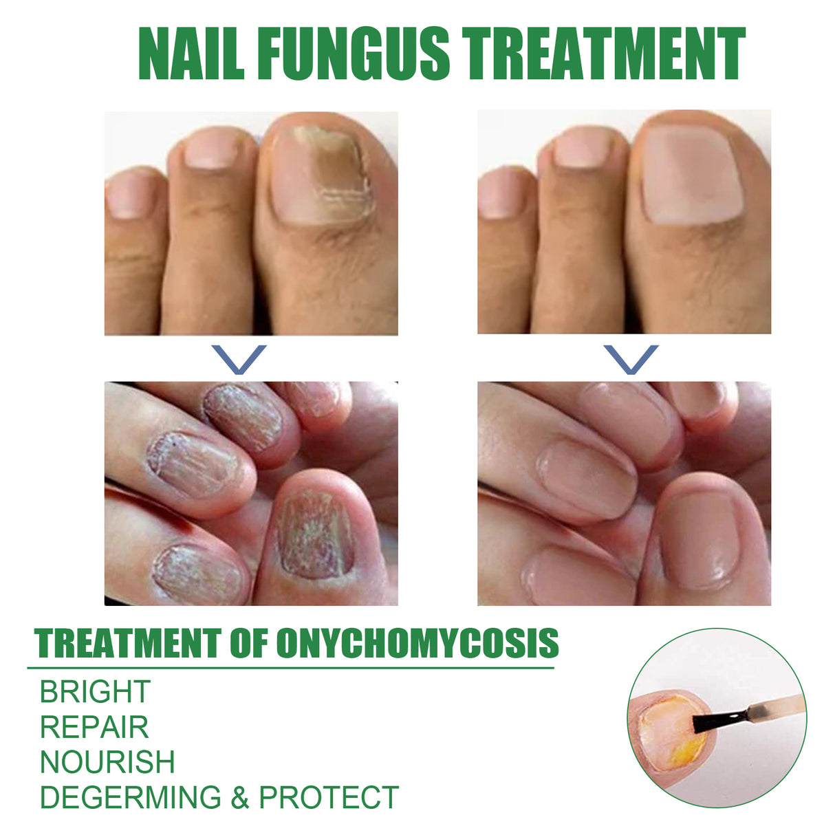 Nail Repair Solution Tea Tree Oil Essence Gentle Nourishing Manicure Cleansing Soft Nail Care Solution - V.I.P Digital Presence