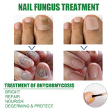 Nail Repair Solution Tea Tree Oil Essence Gentle Nourishing Manicure Cleansing Soft Nail Care Solution - V.I.P Digital Presence