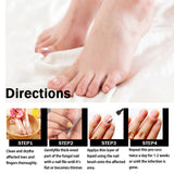 Nail Repair Solution Thickening Brightening Nails Removing Gray Nails Dead Skin Repair Nourishing Nail Care Solution - V.I.P Digital Presence