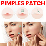 Parche para espinillas, repara marcas de viruela, aclara espinillas, cubre imperfecciones