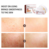 Pigment Repair Cream, Moisturizing And Lightening Freckles Dark Spots Spots Melasma Melanin Beauty Cream - V.I.P Digital Presence