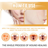 Desalting Skin Scar Cream, Skin Burn Scalding Surgical Scar Wound Repair Cream - V.I.P Digital Presence