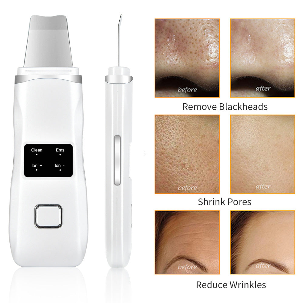 Ultrasonic Peeling Machine HailiCare Positive And Negative Ions Red And Blue Light To Remove Blackheads And Acne Beauty Instrument - V.I.P Digital Presence