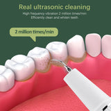 3-Speed Visible Ultrasonic Electric Tooth Cleaner Tooth Cleaning Beauty Instrument To Remove Tartar And Calculus Tooth Cleaning Device - V.I.P Digital Presence