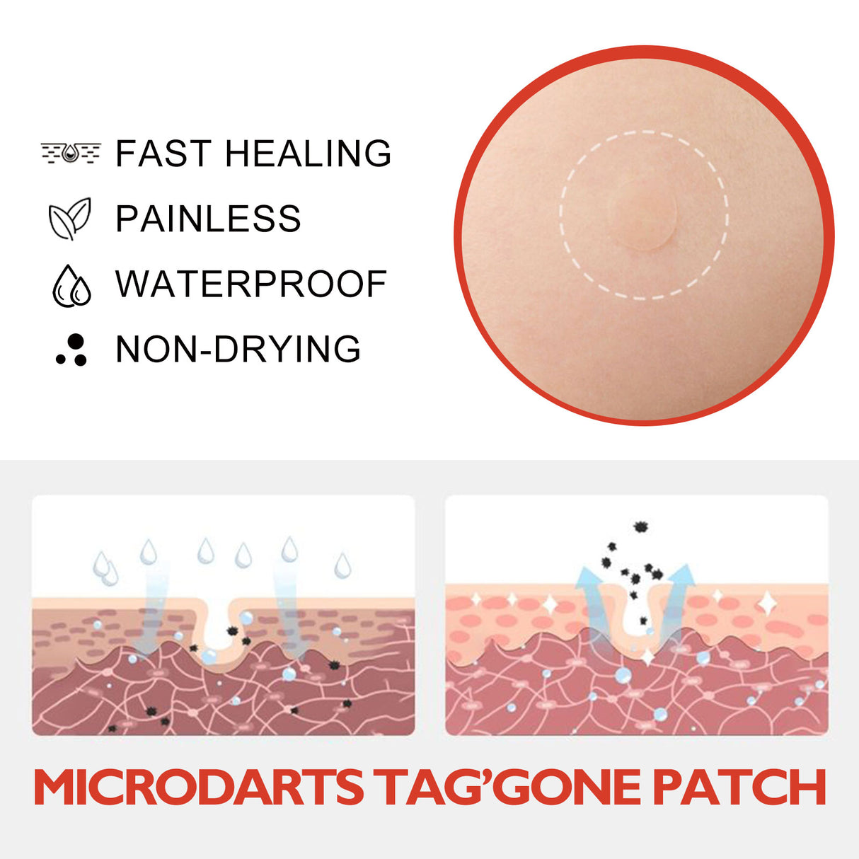 Acne Patch, Skin Clean Acne Pimple Moles Gram Wart Corns Spot Patch - V.I.P Digital Presence