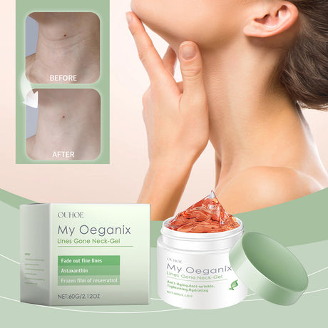 Lines Gone Neck Gel, Neck Moisturizer Improves Neck Lines And Moisturizes Skin Hydrating Gel - V.I.P Digital Presence